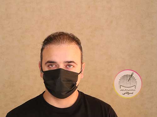 اسکالپ آقایان